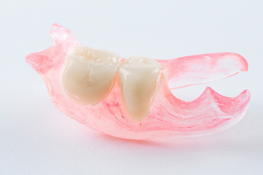 入れ歯（義歯）の治療 - えべおつ歯科（滝川市・江部乙）